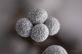 Attēlu rezultāti vaicājumam “Badhamia panicea”