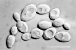 Attēlu rezultāti vaicājumam “Ceratiomyxa morchella spores”