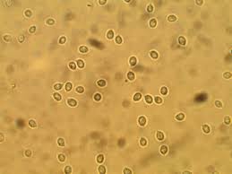 Attēlu rezultāti vaicājumam “Craterium aureum spores”