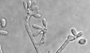 Attēlu rezultāti vaicājumam “Ophiotheca sp.”