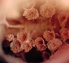 Attēlu rezultāti vaicājumam “Heterotrichia oerstedii (syn. Arcyria oerstedii)”