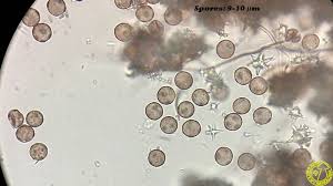 Attēlu rezultāti vaicājumam “Didymium megalosporum spores”
