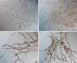 Attēlu rezultāti vaicājumam “Hyaloscypha hyalina”