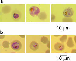 Attēlu rezultāti vaicājumam “Lycogala botrydium plasmodium”