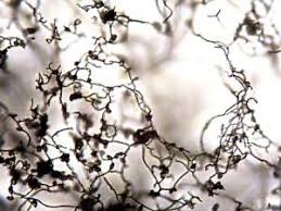 Attēlu rezultāti vaicājumam “Stemonitopsis typhina spores”