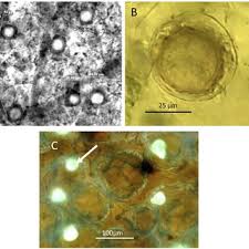 Attēlu rezultāti vaicājumam “Badhamia affinis var. microspora spores”