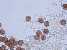 Attēlu rezultāti vaicājumam “Didymium squamulosum spores”