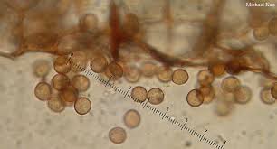 Attēlu rezultāti vaicājumam “Stemonitopsis aequalis (var. aequalis) spores”