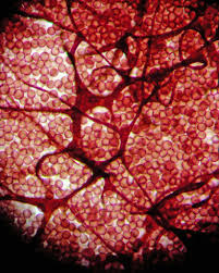 Attēlu rezultāti vaicājumam “Stemonitis marjana stalked”