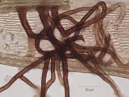 Attēlu rezultāti vaicājumam “Tomentypnum nitens”