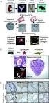<b>stroma endometriale</b> forma