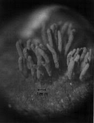 Attēlu rezultāti vaicājumam “Stemonitopsis aequalis var. microspora spores”