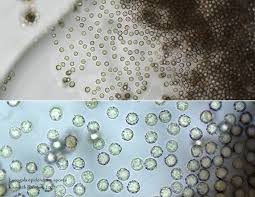 Attēlu rezultāti vaicājumam “Lycogala sp.”