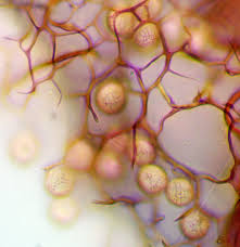 Attēlu rezultāti vaicājumam “Lycogala fuscoolearium young”