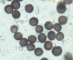 Attēlu rezultāti vaicājumam “Diderma subviridifuscum spores”