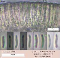 Attēlu rezultāti vaicājumam “Hyalorbilia inflatula”