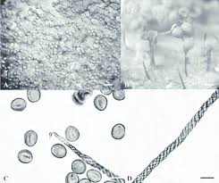 Attēlu rezultāti vaicājumam “Metatrichia floriformis stalked”