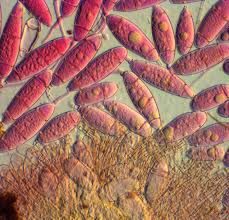 Attēlu rezultāti vaicājumam “Bactridium flavum”