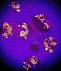 Attēlu rezultāti vaicājumam “Lycogala ustulatum sessile”