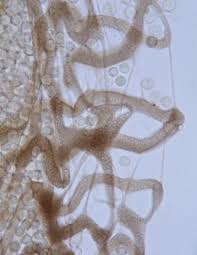 Attēlu rezultāti vaicājumam “Cribraria cancellata var. fusca spores”