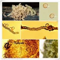 Attēlu rezultāti vaicājumam “Heterotrichia obvelata (syn. Arcyria obvelata) stalked”