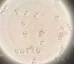 Attēlu rezultāti vaicājumam “Gloeoporus taxicola”