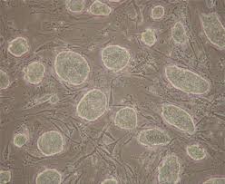 Attēlu rezultāti vaicājumam “Bryum funkii cells”