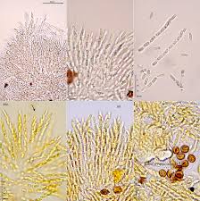 Attēlu rezultāti vaicājumam “Nectriopsis violacea”