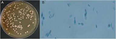 Attēlu rezultāti vaicājumam “Schistidium dupretii sporophyte”
