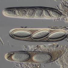 Attēlu rezultāti vaicājumam “Pertusaria leioplaca”