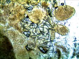 Attēlu rezultāti vaicājumam “Lycogala confusum macro”