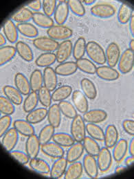 Attēlu rezultāti vaicājumam “Lycogala alisaulianovae young”