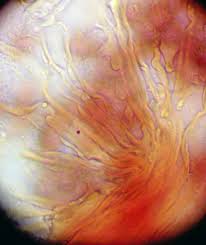 Attēlu rezultāti vaicājumam “Physarum gravidum”