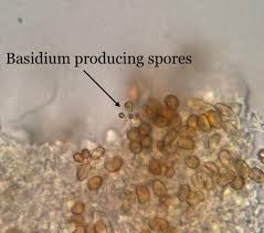 Attēlu rezultāti vaicājumam “Reticularia jurana spores”