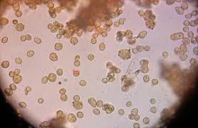 Attēlu rezultāti vaicājumam “Cribraria ferruginea spores”