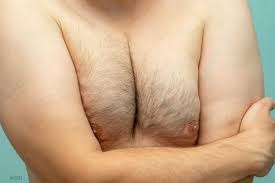 Image result for manboobs