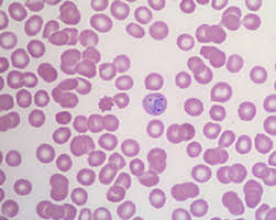 Attēlu rezultāti vaicājumam “Siphoptychium violaceum plasmodium”