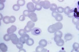 Attēlu rezultāti vaicājumam “Cribraria purpurea plasmodium”