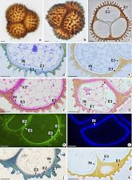 Attēlu rezultāti vaicājumam “Fossombronia wondraczekii spores”