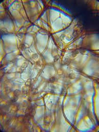 Attēlu rezultāti vaicājumam “Stemonitopsis hyperopta”