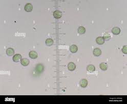 Attēlu rezultāti vaicājumam “Reticularia jurana macro”