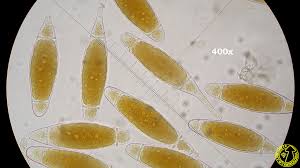 Attēlu rezultāti vaicājumam “Bactridium flavum”