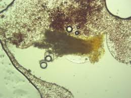 Attēlu rezultāti vaicājumam “Physarum globuliferum”