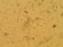 Attēlu rezultāti vaicājumam “Hapalopilus nidulans”