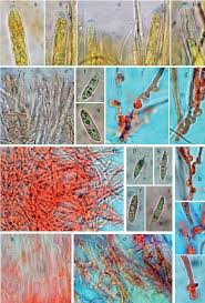 Attēlu rezultāti vaicājumam “Hymenoscyphus calyculus”