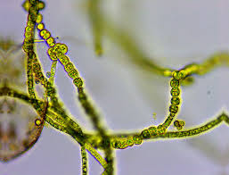 Attēlu rezultāti vaicājumam “Oligonema sp.”