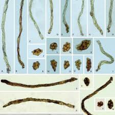 Attēlu rezultāti vaicājumam “Pohlia proligera”