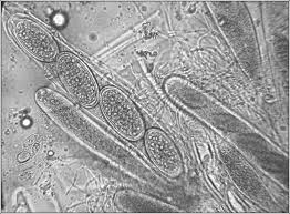Attēlu rezultāti vaicājumam “Pertusaria leioplaca”