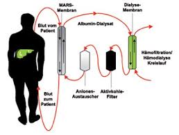 Hepatitis \u0026amp; More - 2011/1 - Ali Canbay, Guido Gerken, Fuat Saner ...