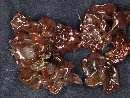 Attēlu rezultāti vaicājumam “Tremella foliacea”